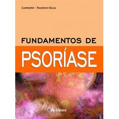 Fundamentos de Psoríase