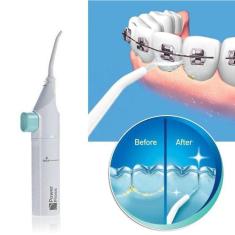 Irrigador Dental Jato Limpeza Dental Dente Gengiva Oral Bucal Boca Aparelho Fio Dental Água Manual