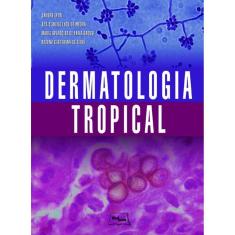 Dermatologia Tropical