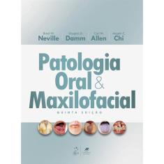Patologia Oral e Maxilofacial