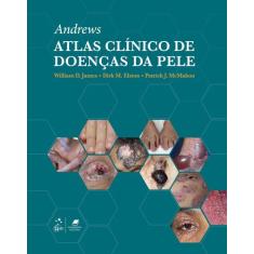 Livro - Andrews Atlas Clínico De Doenças Da Pele