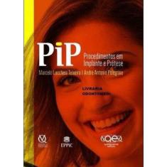 Livro Pip Procedimentos Em Implante E Prótese - Lucchesi Pelegrine - Q