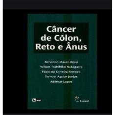 Cancer De Colon, Reto E Anus