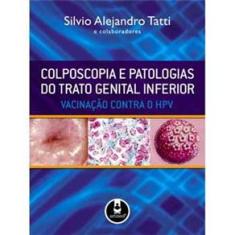 Livro - Colposcopia e Patologias do Trato Genital Inferior: Vacinação Contra o HPV