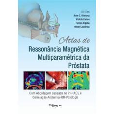 Atlas de ressonancia magnetica multiparametrica da prostata