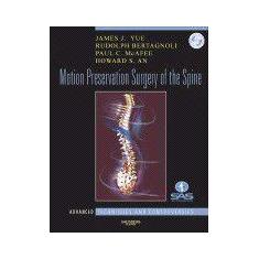 Motion Preservation Surgery Of The Spine