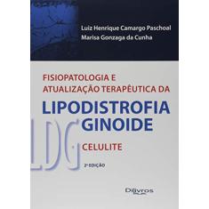 Fisiopatologia e Atualização Terapêutica da Lipodistrofia Ginoide LDG. Celulite