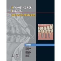 Livro - Especialidades Em Imagens - Implantes Dentários