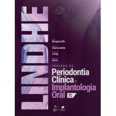 Livro - Tratado de Periodontia Clinica e Implantologia Oral