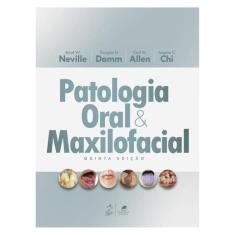 Patologia Oral E Maxilofacial