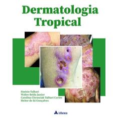 Livro - Dermatologia Tropical
