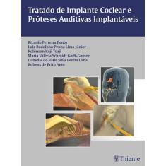 Livro - Tratado De Implante Coclear E Próteses Auditivas Implantáveis