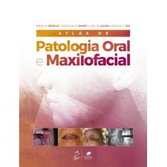 Livro - Atlas De Patologia Oral E Maxilofacial