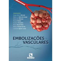 Embolizações Vasculares - rubio