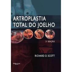 Artroplastia Total Do Joelho
