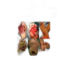 Livro Uma Abordagem Multidisciplinar Sobre Pé Diabét Batista - Andreol