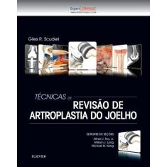 Tecnicas De Revisao De Artroplastia Do Joelho