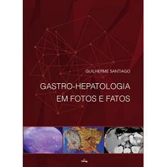 Gastro-Hepatologia em Fotos e Fatos