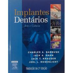 Implantes dentarios: arte e ciencia - ELSEVIER BRASIL (PROF)