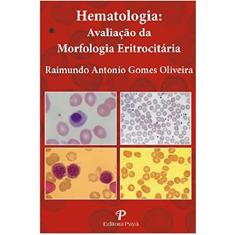 Hematologia: Avaliação da Morfologia Eritrocitária