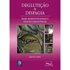 Deglutição E Disfagia - Medbook