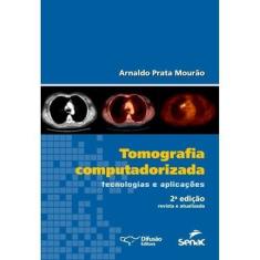 Tomografia Computadorizada