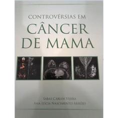 Controversias Em Cancer De Mama