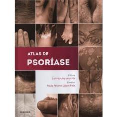Atlas De Psoriase