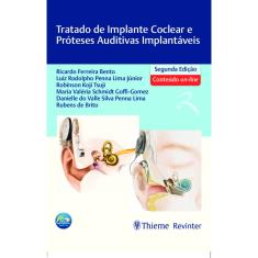 Tratado De Implante Coclear E Proteses Auditivas Implantaveis