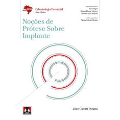 Livro - Noções de Prótese Sobre Implante
