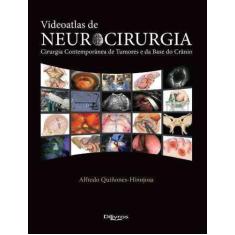 Livro Videoatlas De Neurocirurgia