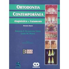 Ortodontia Contemporânea: Diagnóstico e Tratamento