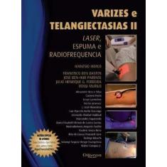 Livro Varizes E Telangiectasias IiLivroLaser, Espuma E Radiofrequencia