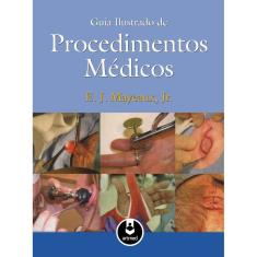 Guia Ilustrado De Procedimentos Medicos