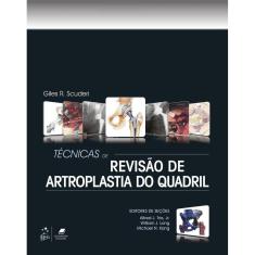 Tecnicas De Revisao De Artroplastia Do Quadril