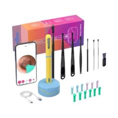 Conjunto De Limpeza De Ouvido HD Com Câmera USB C Otoscópio Ferramenta