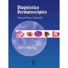 Diagnóstico Dermatoscópico: Manual Prático Ilustrado