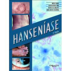 Hanseniase