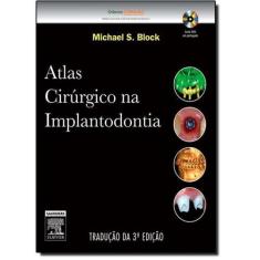 Atlas Cirúrgico Na Implantodontia
