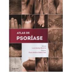 Atlas De Psoriase - Elsevier Hs - Clinical Solutio