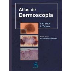 Livro - Atlas de Dermoscopia