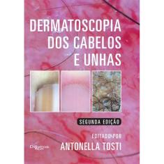 Dermatoscopia Dos Cabelos E Unhas
