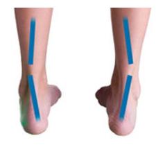 Palmilha Para Pisada Supinada Corretiva Dia A Dia - Substitui Tênis Su