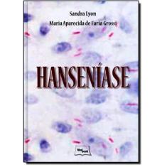 Hanseniase
