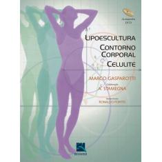Livro - Lipoescultura, Contorno Corporal, Celulite