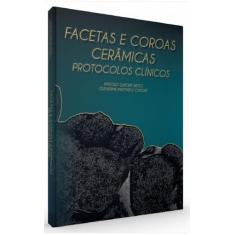 Facetas E Coroas Cerâmicas  Protocolos Clínicos - Santos Publicações