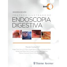 SOBED Tratado Ilustrado de Endoscopia Digestiva