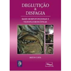 Degluticao E Disfagia - Medbook