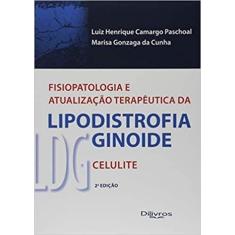 Fisiopatologia e atualizacao terapeutica da lipodistrofia ginoide - ld