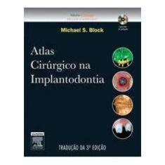 Atlas Cirurgico Na Implantodontia (Com Dvd)